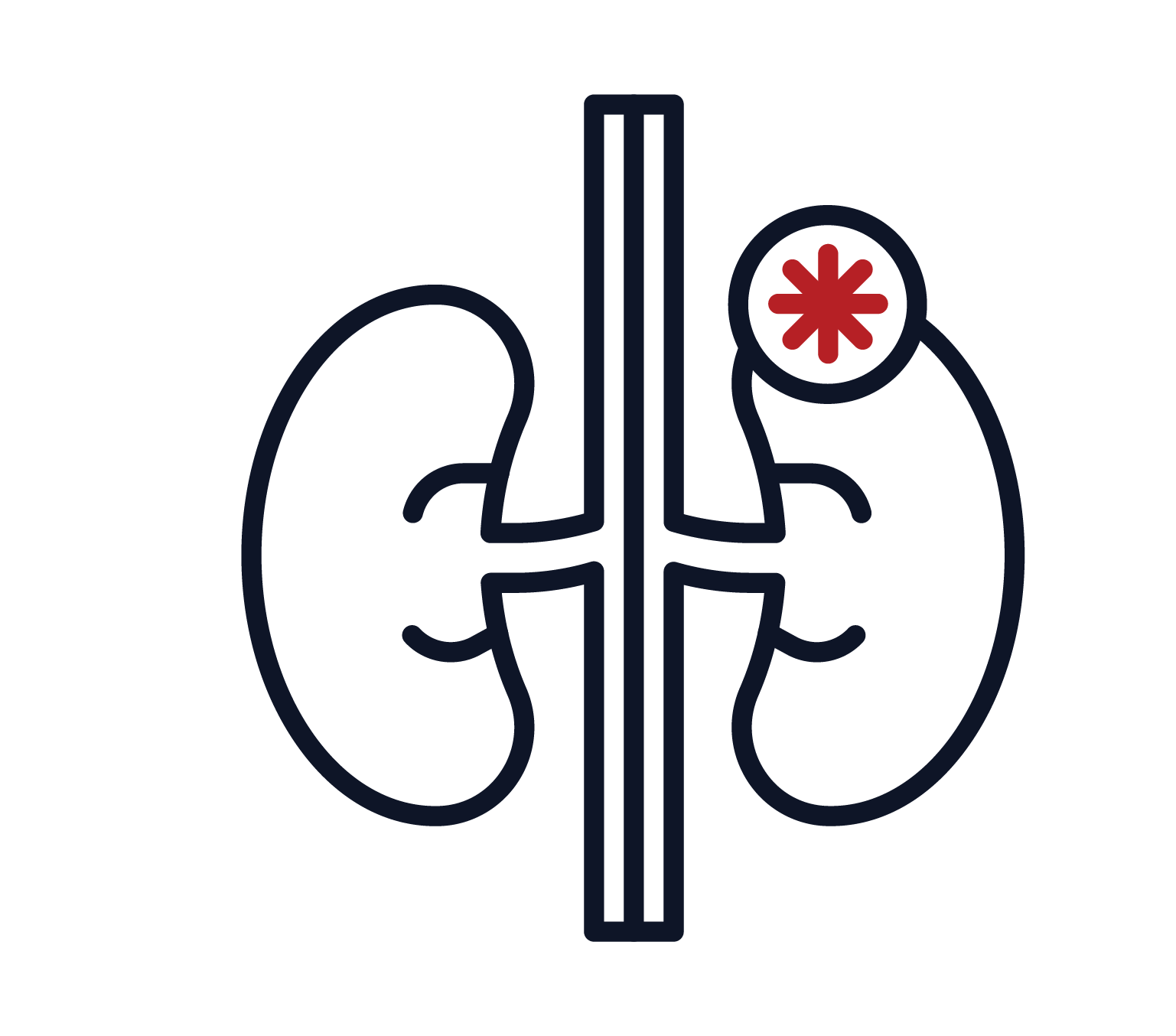 Chronic Kidney Disease